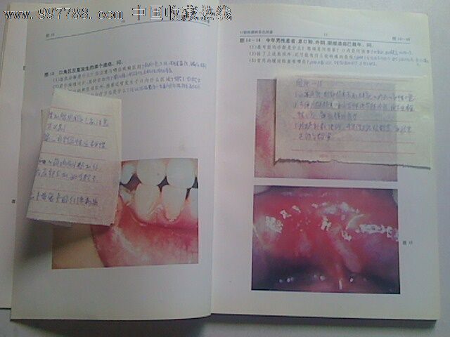 口腔粘膜病彩色图谱(图谱都有专家亲自用笔详细注解病情特点看图非常